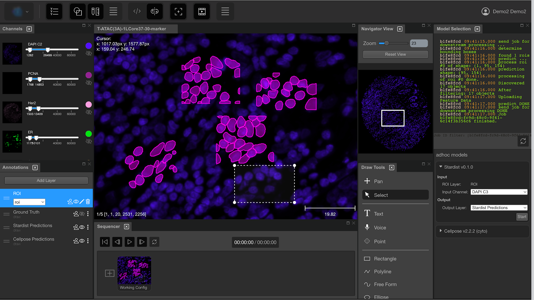 a screenshot of the viewer: using segmentation algorithms